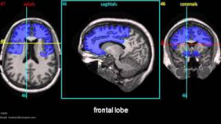 Brain MRI Anatomy Module Tutorial [upl. by Nadabus]