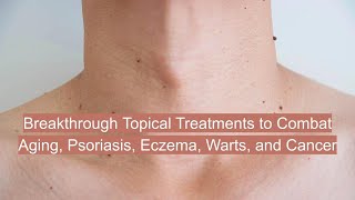 Topical Treatments for Psoriasis Eczema Warts and Aging health aging longevity inflammation [upl. by Kcorb]