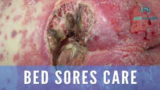 Bed Sores Care in Hindi  Vaga Hospital Med Class [upl. by Anelak519]