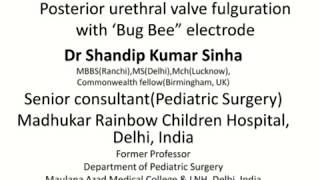 Posterior urethral valvePUV fulgration by bug bee electrode [upl. by Nelak]