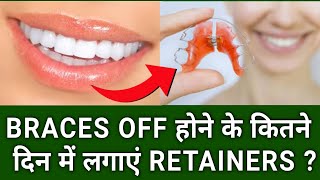 Braces हटने के कितने दिन बाद लगवाएं Retainers  When Retainers after getting Braces off [upl. by Akselaw404]