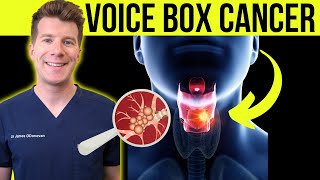 Doctor explains Laryngeal cancer voicebox cancer  Symptoms causes and treatment [upl. by Roze]