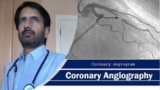 The Angiography Angiogram Procedure  How do doctors perform this procedure [upl. by Onitnatsnoc192]