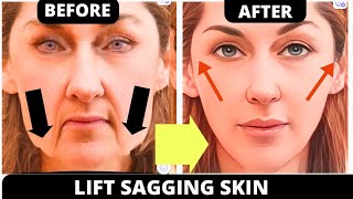 🛑 ANTIAGING FACE EXERCISES FOR SAGGING SKIN JOWLS NASOLABIAL FOLDS FOREHEAD LINES MOUTH LINES [upl. by Ahsercel935]