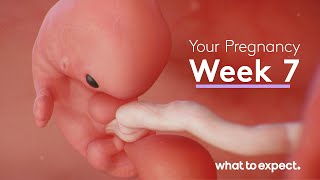 7 Weeks Pregnant  What to Expect [upl. by Yelhsa]