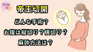 帝王切開ってどんな手術？お腹は縦切り、横きりどっち？麻酔方法は？ [upl. by Eytteb]