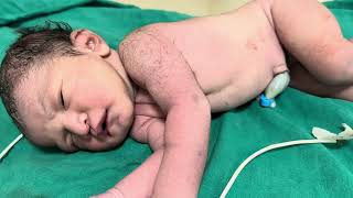 Newborn baby day12newborn mini vlog baby video [upl. by Soirtimid]