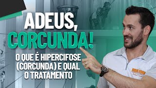 O QUE É HIPERCIFOSE CORCUNDA E QUAL O TRATAMENTO  1ªEPISÓDIO  Fisioprev com Guilherme Stellbrink [upl. by Moersch]