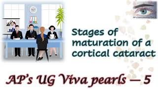 Stages of Maturation of a Cortical Cataract APs UG Viva Pearls 5 [upl. by Groos]