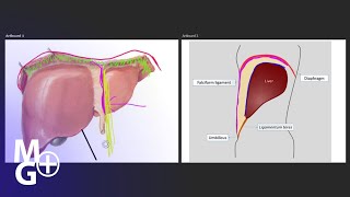 Ligamentul FALCIFORM Anatomie [upl. by Ardeid]