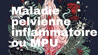 Maladie pelvienne inflammatoire ou MPU [upl. by Alicul]