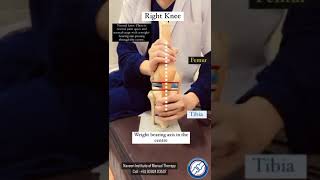 Kinematics of valguslateral knee arthritis [upl. by Juliann128]