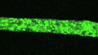 Neurospora organelle structuremov [upl. by Saile675]