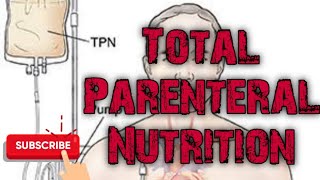 Total Parenteral Nutrition  Hyper alimentation [upl. by Arbmat]