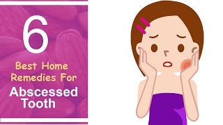 6 Best Home Remedies For Abscessed Tooth [upl. by Uhsoj99]