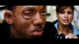 Urticaria Angioedema Hitch Allergic reaction scene [upl. by Ahsiei]