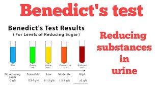 Benedicts test  Reducing substances in urine Biochemistry [upl. by Lenee531]