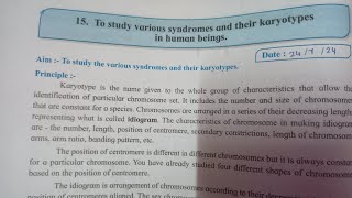 12th biology experiment no 15 to study various syndromes and their karyotypes in human being [upl. by Gilly]