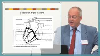 Filière Cardiogen Le Défibrillateur Automatique Implantable  DAI [upl. by Noevart]