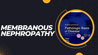 Membranous nephropathy  Pathogenesis  Morphology  Clinical features [upl. by Nievelt108]