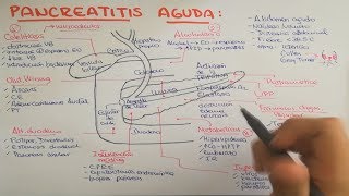 Pancreatitis causas fisiopatología clínica diagnóstico y tratamiento [upl. by Pelletier]