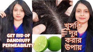 খুসকি দূর করার উপায় Khuski dur korar upai How to Treat Dandruff at Home [upl. by Pascasia136]