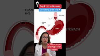 Understanding Hemorrhagic Gastric Ulcers anatomy meded 3danimation [upl. by Georgine]