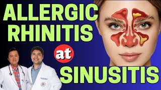 Allergic Rhinitis at Sinusitis  Payo ni Doc Gim Dimaguila ENT Doctor at Doc Willie Ong [upl. by Lubet]