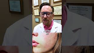 Is Retinol Really Worth It shorts skincare dermatology [upl. by Rehc]