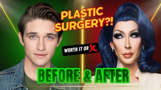 Celebs Who Went TOO FAR with Plastic Surgery [upl. by Gustafson]