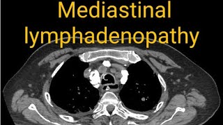 Lymph nodes  CT scan chest plain  CT scan chest medistian and Lungs window [upl. by Mateusz]