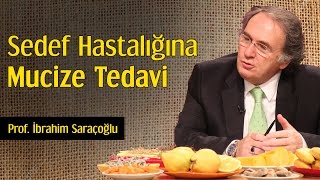 Sedef Hastalığına Mucize Tedavi  Prof İbrahim Saraçoğlu [upl. by Trumaine]