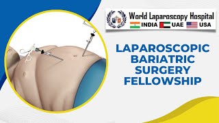 Laparoscopic Bariatric Surgery Fellowship at World Laparoscopy Hospital [upl. by Slosberg776]