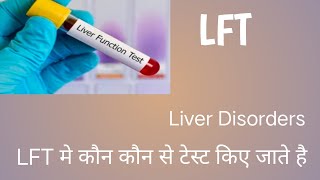 Liver Function Test [upl. by Erialcyram217]