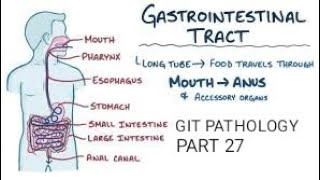 Intestine cystic fibrosis Environment enteropathy amp autoimmune enteropathygit pathology [upl. by Anele585]