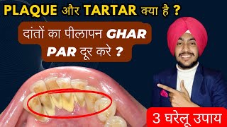 3 Home Remedies to Remove Dental Palque  What is Plaque or Calculus  Solution for Yellowish Teeth [upl. by Lotsirb439]