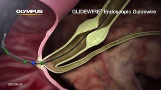 GLIDEWIRE Endoscopic Hydrophilic Coated Guidewire Animation [upl. by Woods]