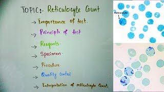 Reticulocyte count principleprocedure and importance in Hindi Urdu and English [upl. by Cherie]