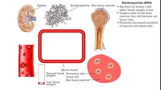 A patient’s guide Red blood cell exchange and sickle cell disease [upl. by Adnohsar775]