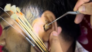 ASMR ear cleaning [upl. by Meta]