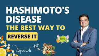 What is Hashimotos Disease Symptoms of Hashimotos  The Best way to Reverse Hashimotos Disease [upl. by Kinzer387]