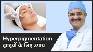 Treatments For Hyperpigmentation झाइयों के लिए उपाय Part 3  ClearSkin Pune  In HINDI [upl. by Hecklau334]