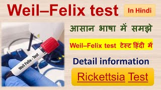 Weil–Felix test  Test for Rickettsia  Detail information in Hindi [upl. by Yrrek]