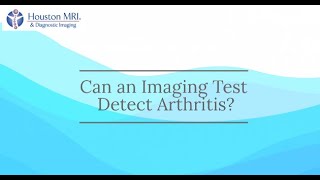 Can an Imaging Test Detect Arthritis [upl. by Mellitz684]