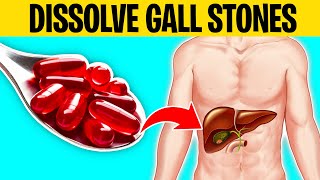 6 Vitamins That Dissolve Gallstones [upl. by Oznarol]