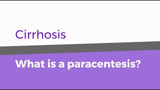 Cirrhosis – What is a paracentesis [upl. by Pendleton45]