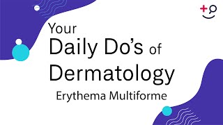 Erythema Multiforme  Daily Dos of Dermatology [upl. by Denison]