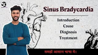 Sinus Bradycardia  Cause Symptoms Treatment  Low Heart Rate  Sedative Doctor bradycardia [upl. by Georgianne461]