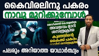 കൈവിരലിനു പകരം നാവു മുറിക്കുമ്പോൾപലരും അറിയാത്ത യാഥാർത്ഥ്യം  AcuMasterShuhaib Riyaloo [upl. by Sasnett]