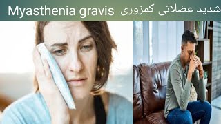 Myasthenia gravis [upl. by Shanks]